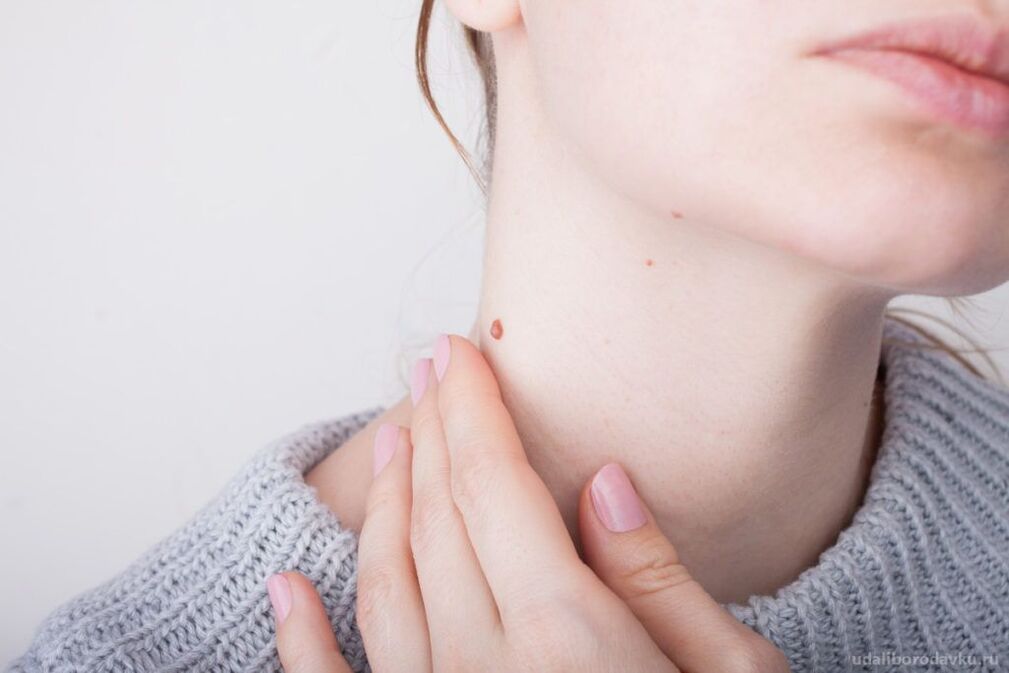 Patogênese do HPV