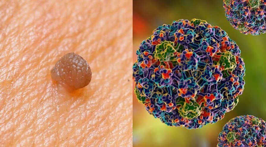Rotas de transmissão do HPV
